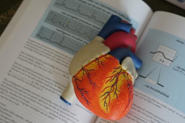 Interventional Cardiology